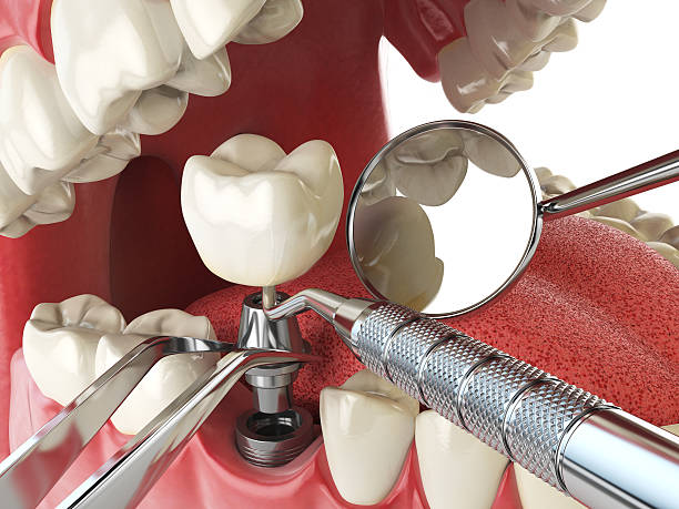 Best Emergency Treatment for Toothache in Muenster, TX