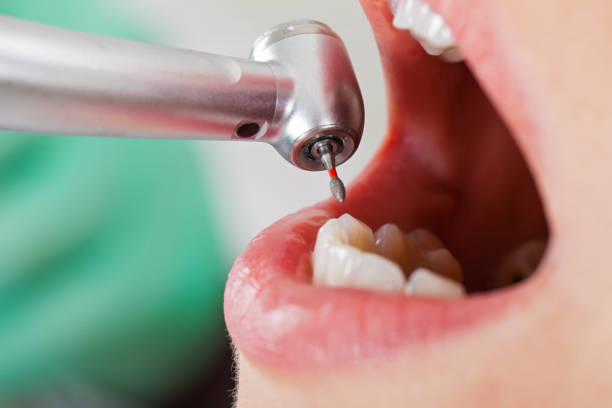 Best Walk-In Emergency Dentist in Muenster, TX